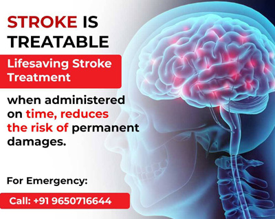 Brain Stroke Treatment in Delhi NCR